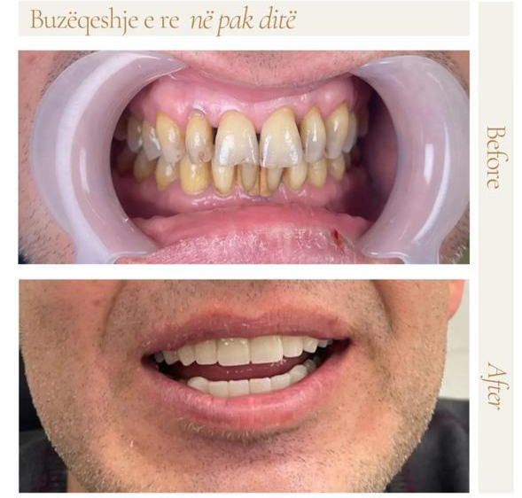 Klinika Dentare Bitincka