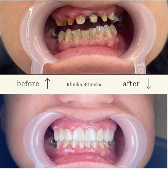 Klinika Dentare Bitincka