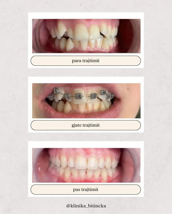 Klinika Dentare Bitincka