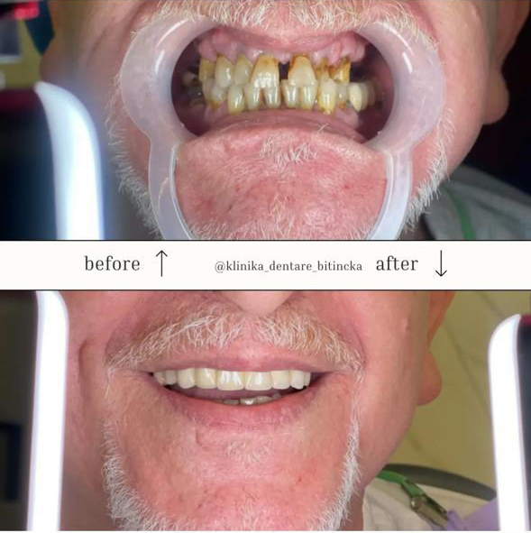 Klinika Dentare Bitincka