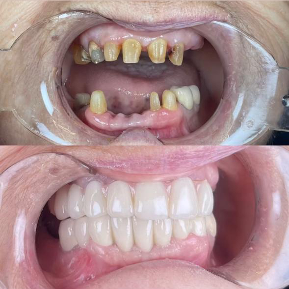 Klinika Dentare Bitincka