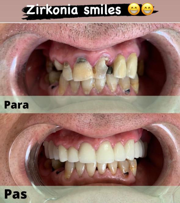 Klinika Dentare Bitincka