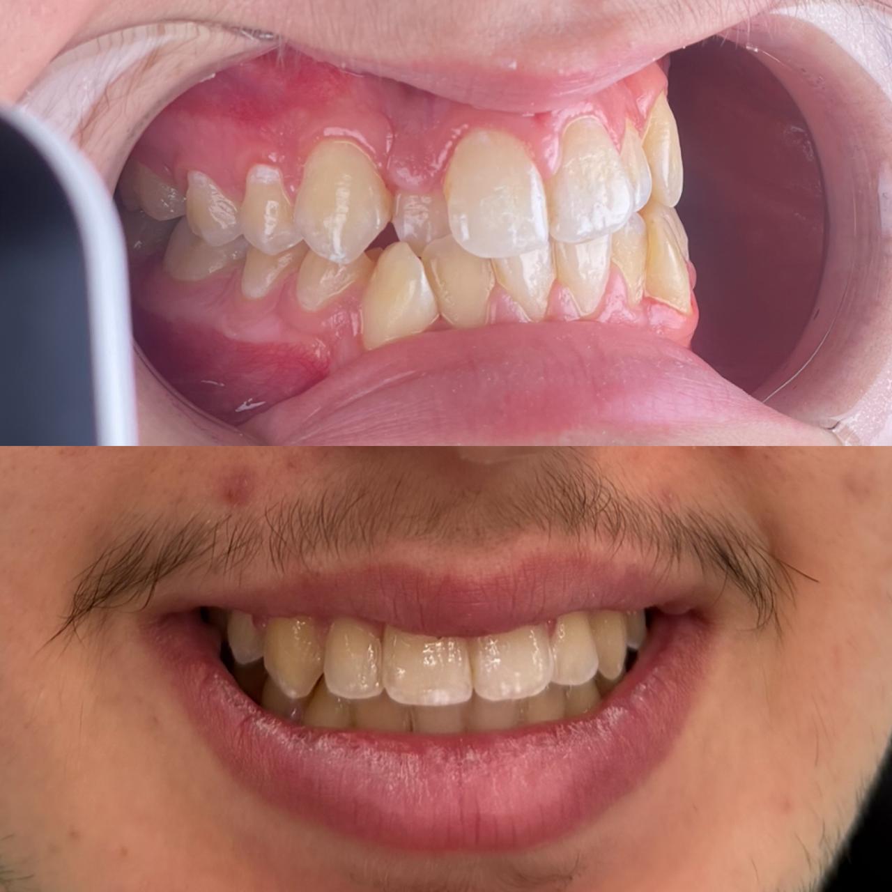 Klinika Dentare Bitincka