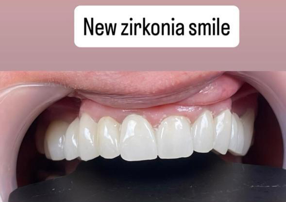 Klinika Dentare Bitincka